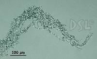Nostoc caeruleum image